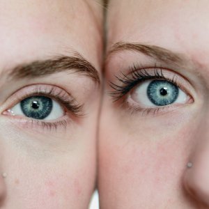 DER VERLORENE ZWILLING UND DIE 2 LEBEN DES FALCO